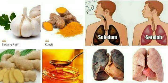 Pembersih Nikotin dan Tar di Paru-paru anda